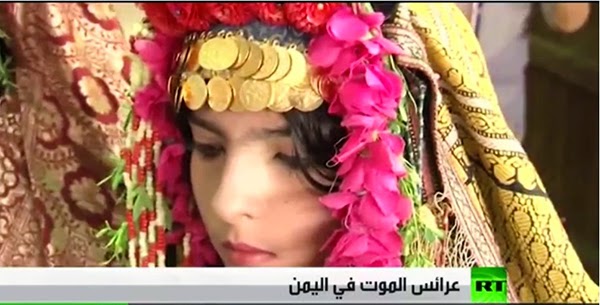 وفاة عروس عمرها 8 سنوات ليلة زفافها باليمن بسبب وحشية زوجها