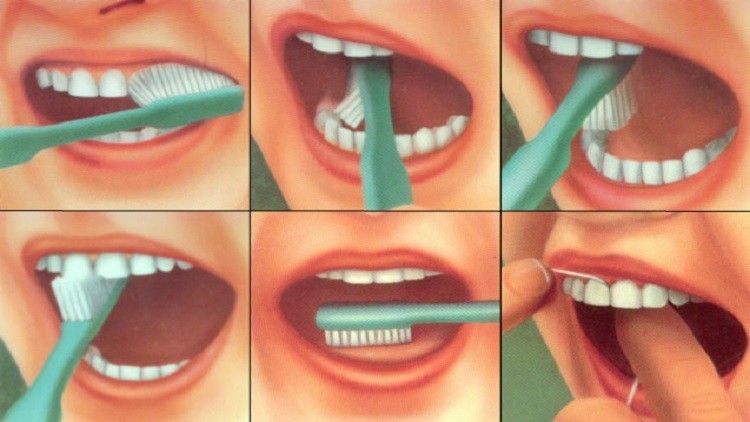 أطباء ينصحون بالإقلال من تنظيف الأسنان